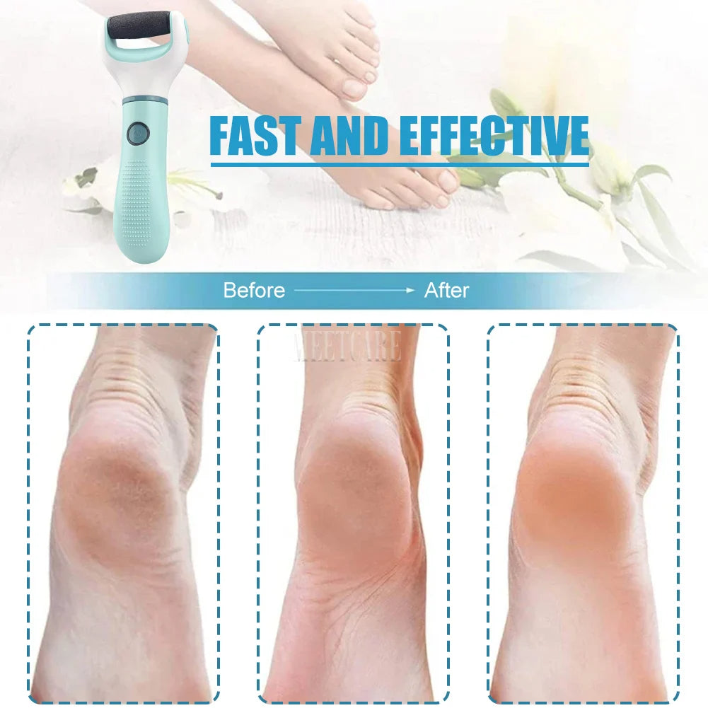 Auto Wireless Electric Foot Grinder Removal Dead Skin Calluses Cracks Hard Skin Pedicure Care Tool Waterproof Foot Cleaner ﻿